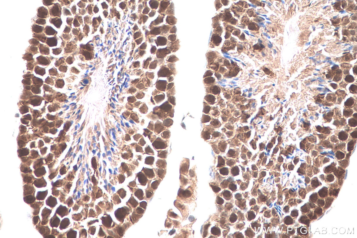 Immunohistochemical analysis of paraffin-embedded mouse testis tissue slide using KHC0779 (CSE1L IHC Kit).