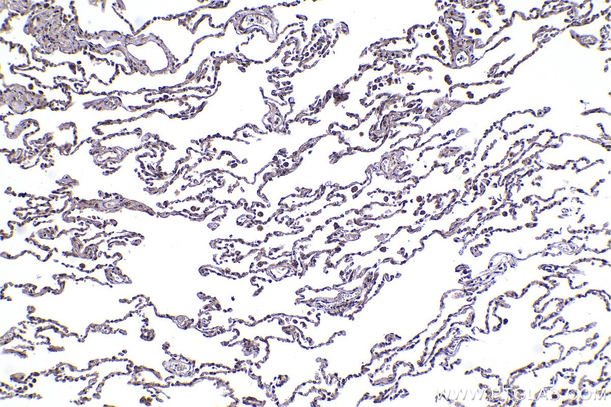 Immunohistochemical analysis of paraffin-embedded human lung tissue slide using KHC2259 (CSK IHC Kit).