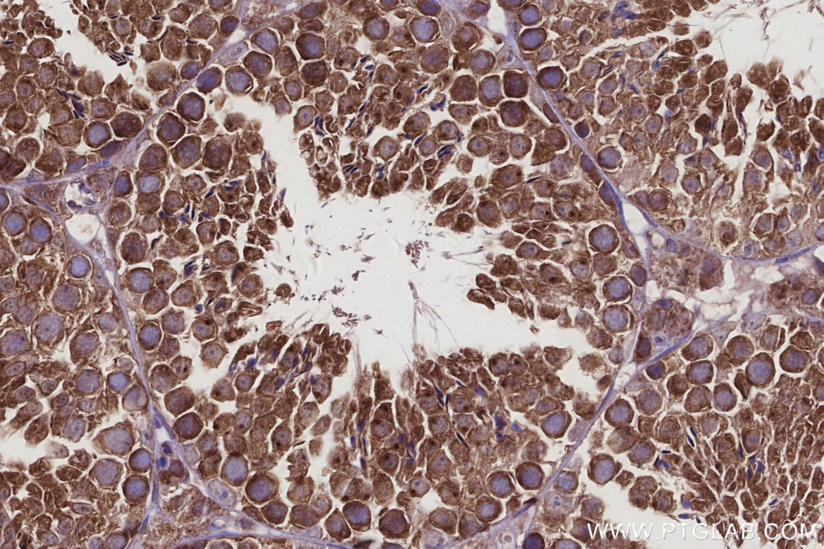 Immunohistochemical analysis of paraffin-embedded mouse testis tissue slide using KHC2932 (CSNK1G1 IHC Kit).