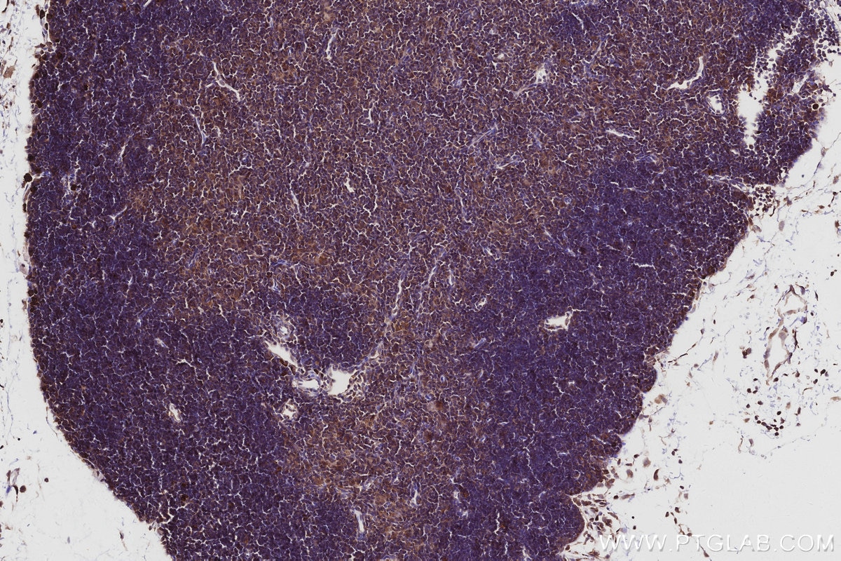 Immunohistochemical analysis of paraffin-embedded mouse thymus tissue slide using KHC2932 (CSNK1G1 IHC Kit).
