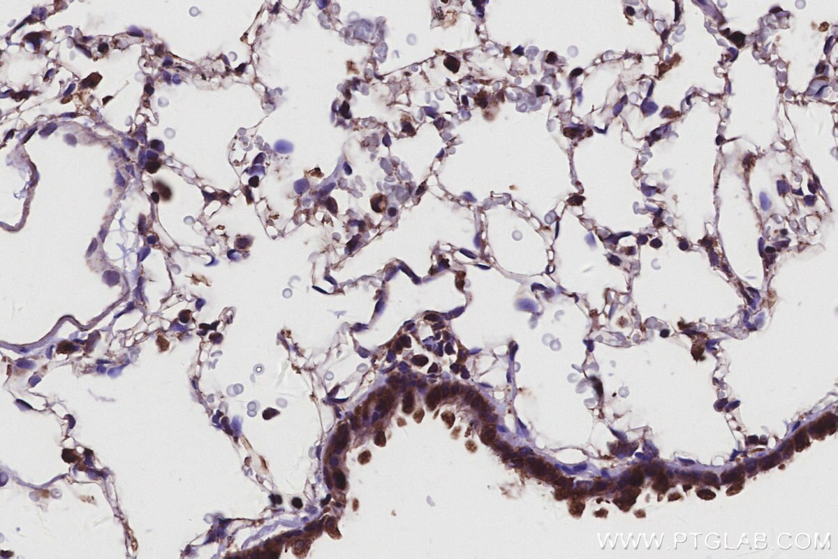Immunohistochemical analysis of paraffin-embedded rat lung tissue slide using KHC2932 (CSNK1G1 IHC Kit).