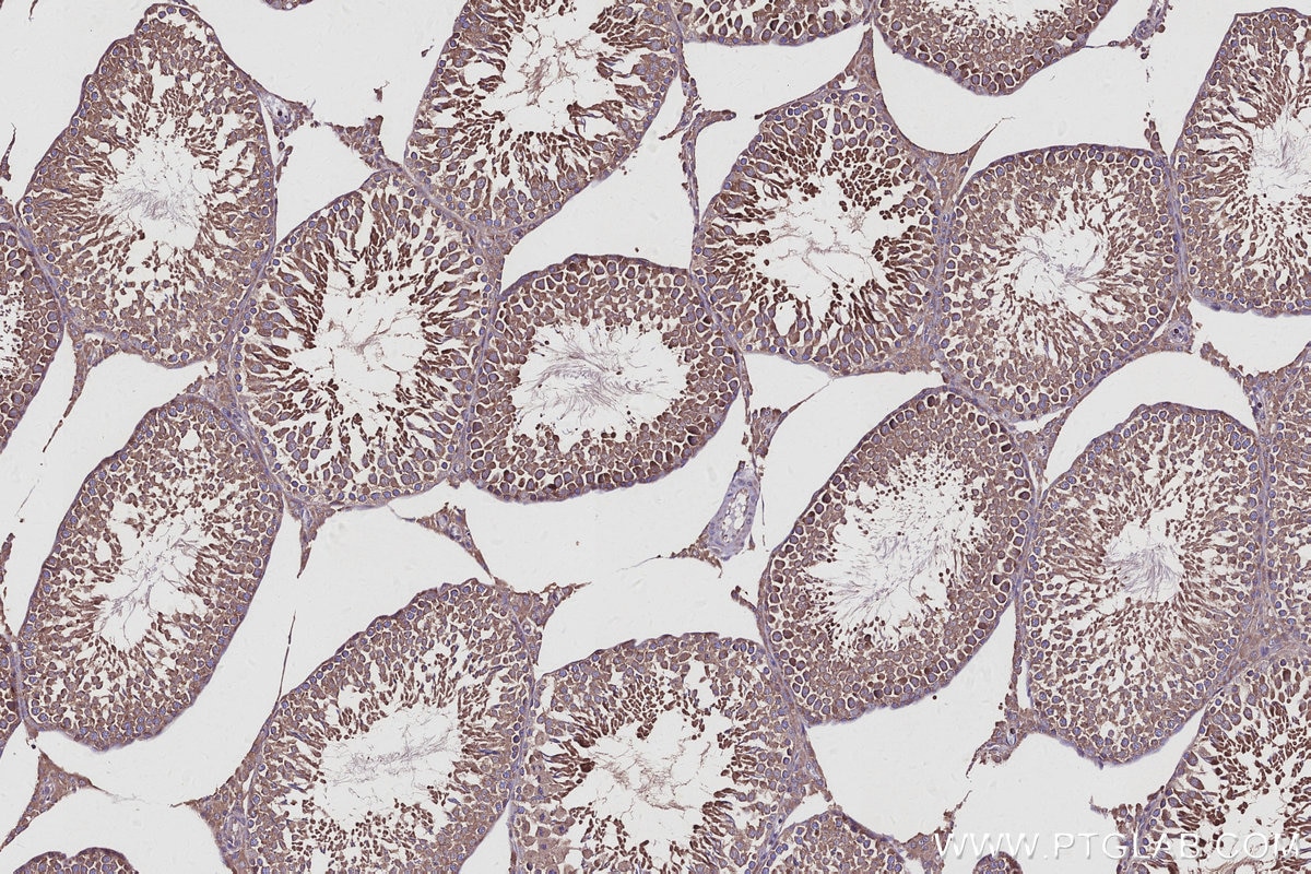 Immunohistochemical analysis of paraffin-embedded rat testis tissue slide using KHC2932 (CSNK1G1 IHC Kit).