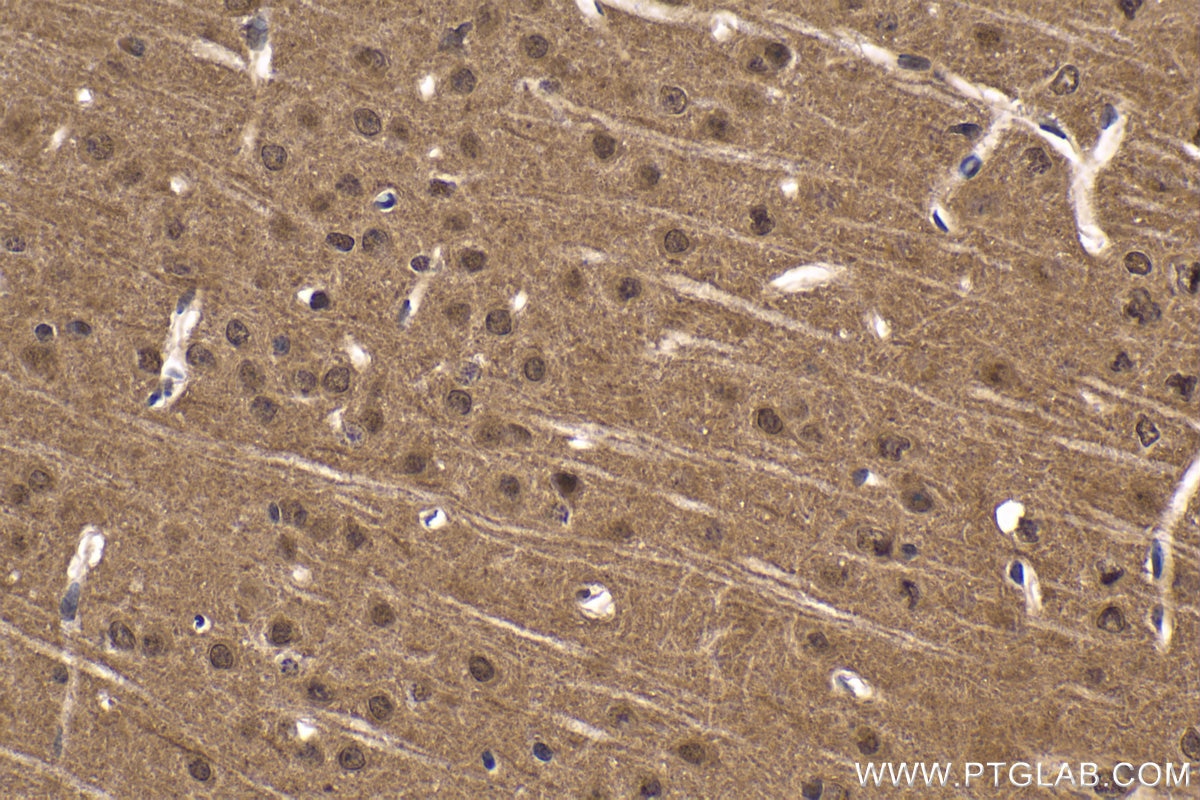 Immunohistochemical analysis of paraffin-embedded mouse brain tissue slide using KHC1651 (CSNK2A1 IHC Kit).