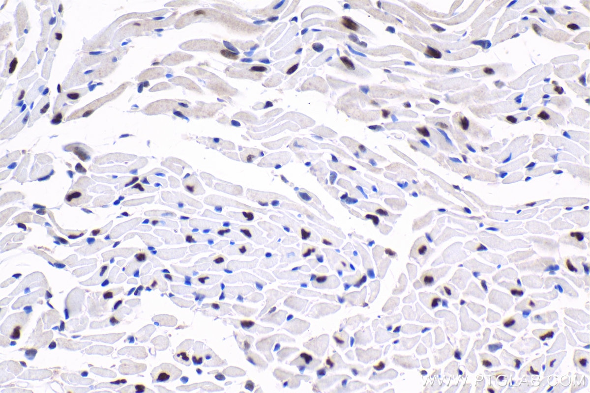 Immunohistochemical analysis of paraffin-embedded mouse heart tissue slide using KHC1651 (CSNK2A1 IHC Kit).