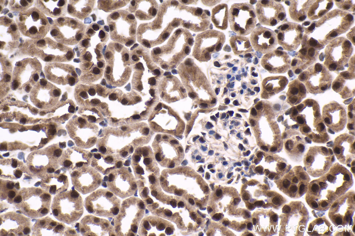 Immunohistochemical analysis of paraffin-embedded mouse kidney tissue slide using KHC1651 (CSNK2A1 IHC Kit).