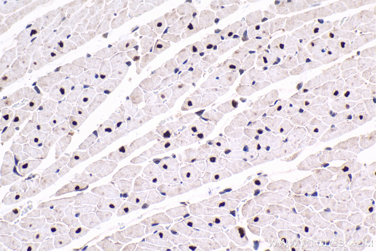 Immunohistochemical analysis of paraffin-embedded rat heart tissue slide using KHC1651 (CSNK2A1 IHC Kit).