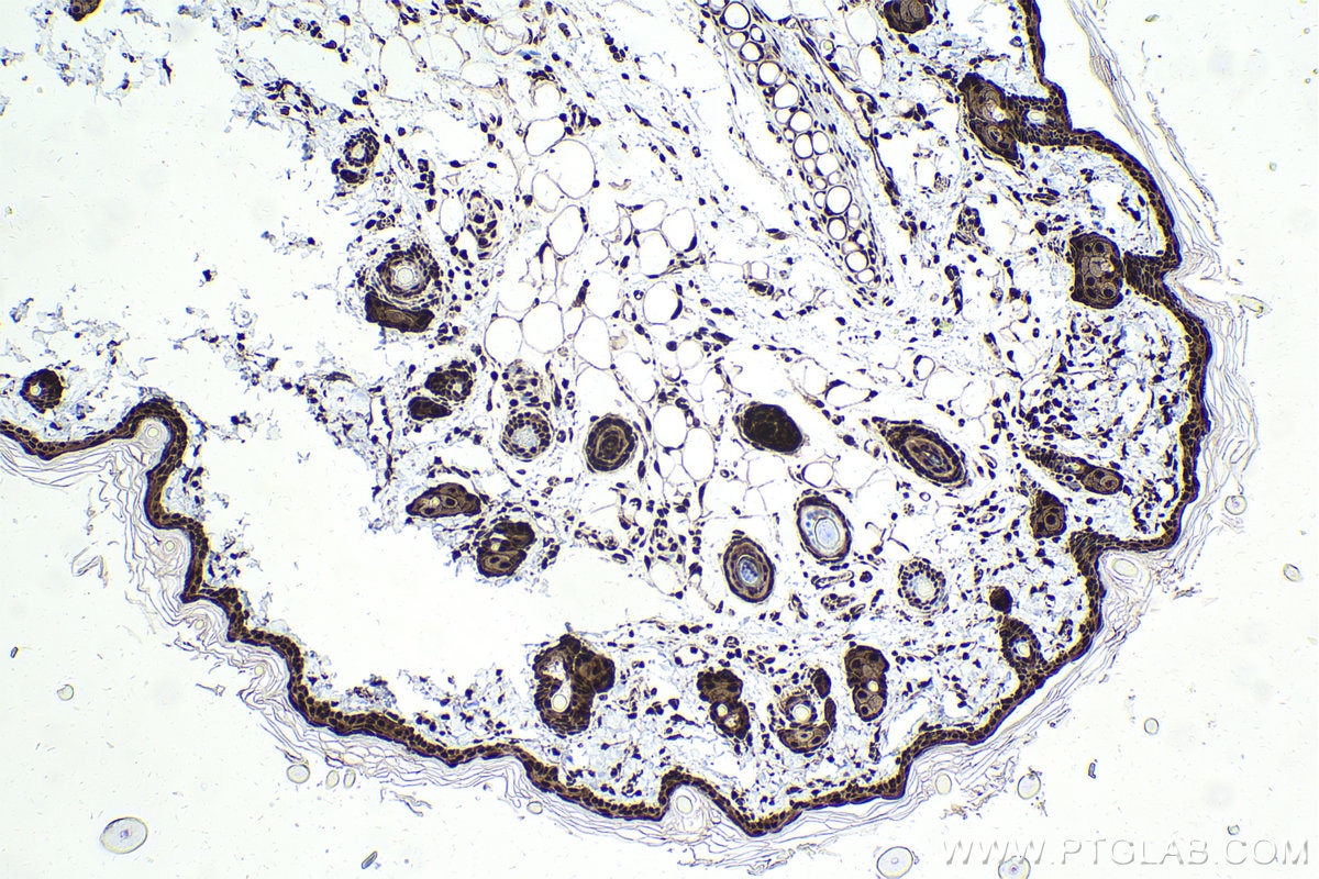 Immunohistochemical analysis of paraffin-embedded rat skin tissue slide using KHC1650 (CSNK2B IHC Kit).