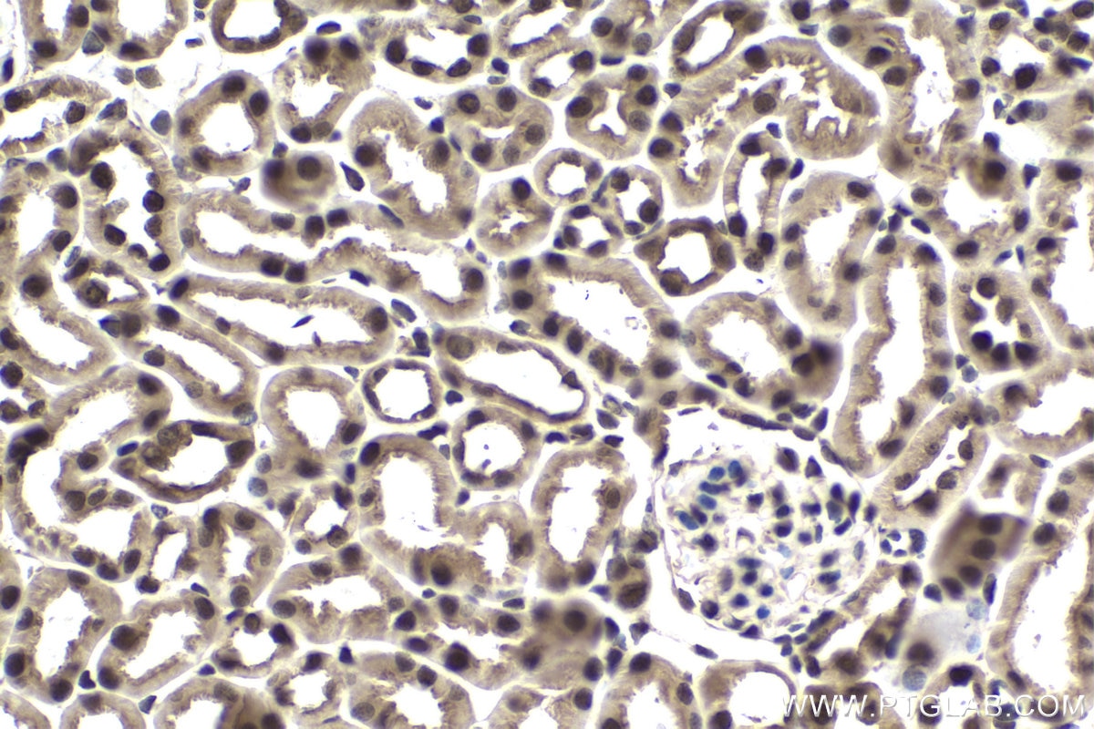 Immunohistochemical analysis of paraffin-embedded mouse kidney tissue slide using KHC1650 (CSNK2B IHC Kit).