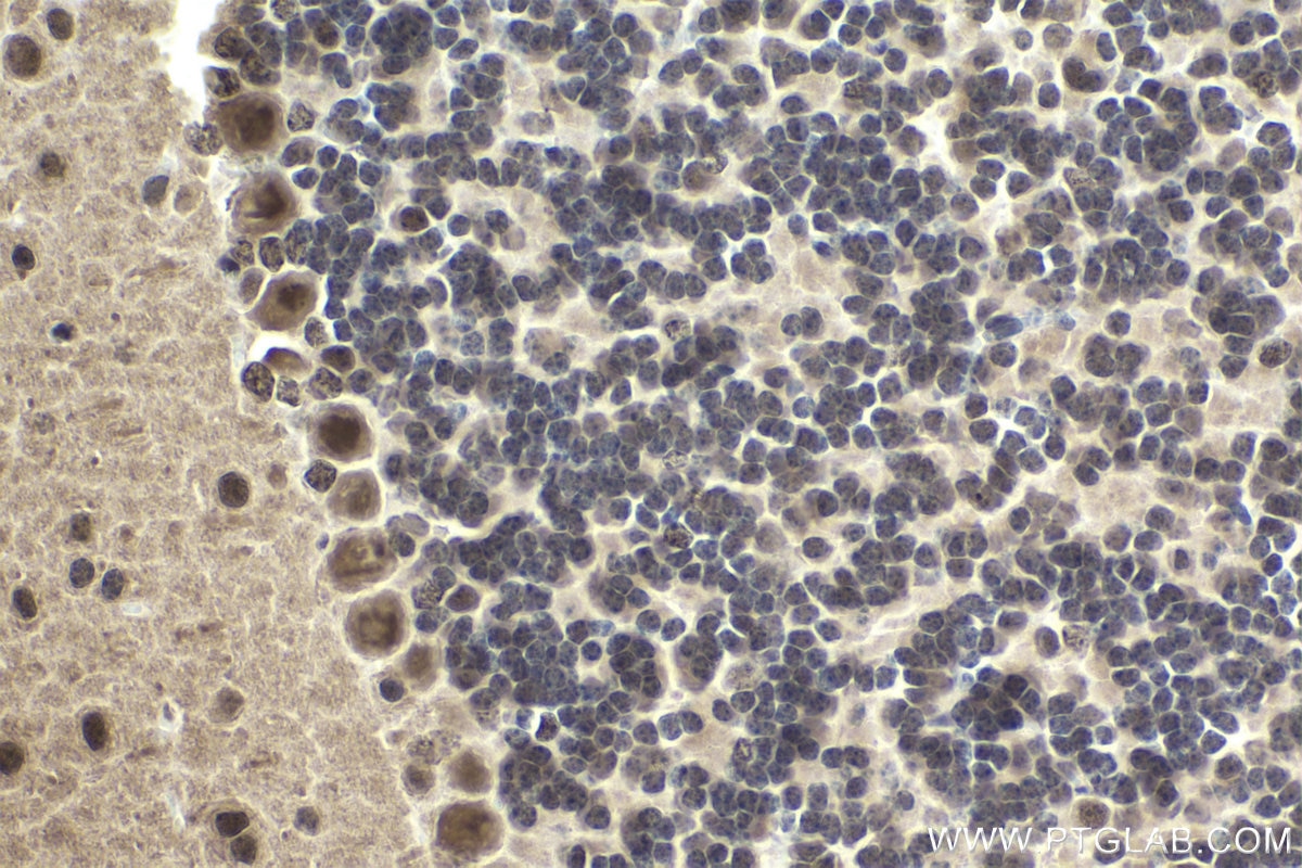 Immunohistochemical analysis of paraffin-embedded mouse cerebellum tissue slide using KHC1650 (CSNK2B IHC Kit).