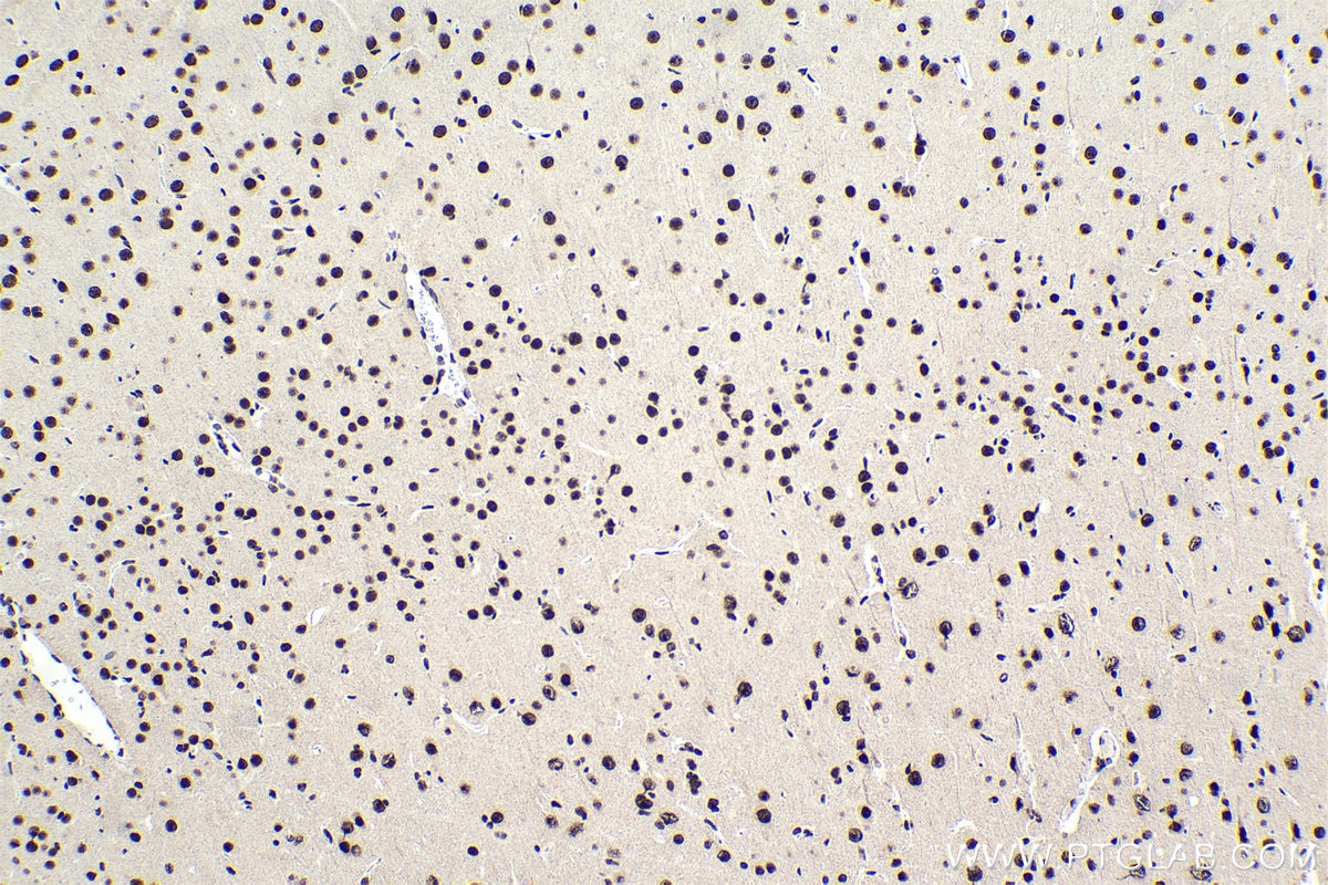 Immunohistochemical analysis of paraffin-embedded rat brain tissue slide using KHC1580 (CSTF2 IHC Kit).