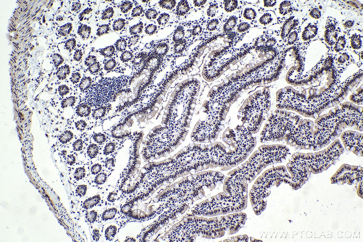Immunohistochemical analysis of paraffin-embedded rat small intestine tissue slide using KHC1698 (CSTF3 IHC Kit).