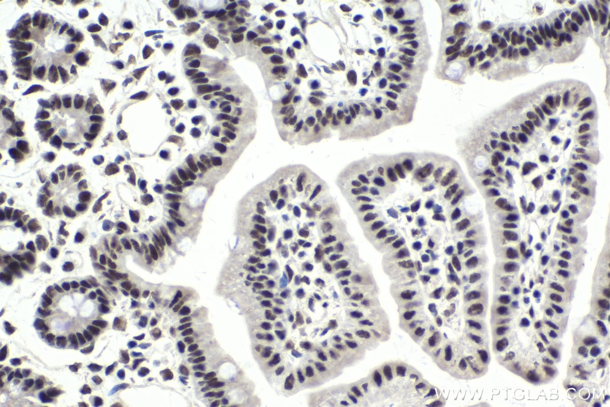 Immunohistochemical analysis of paraffin-embedded mouse small intestine tissue slide using KHC1698 (CSTF3 IHC Kit).