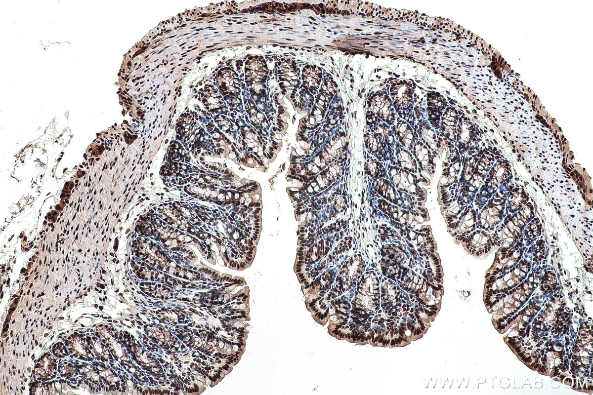 Immunohistochemical analysis of paraffin-embedded mouse colon tissue slide using KHC0945 (CTBP1 IHC Kit).