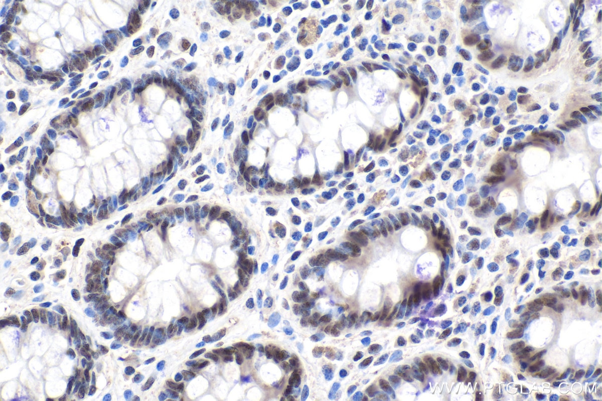 Immunohistochemical analysis of paraffin-embedded human colon tissue slide using KHC1633 (CTBP2 IHC Kit).
