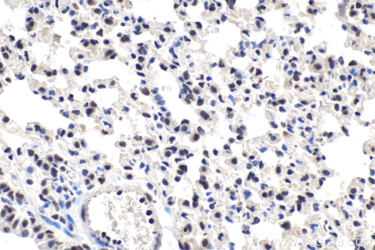 Immunohistochemical analysis of paraffin-embedded mouse lung tissue slide using KHC1633 (CTBP2 IHC Kit).