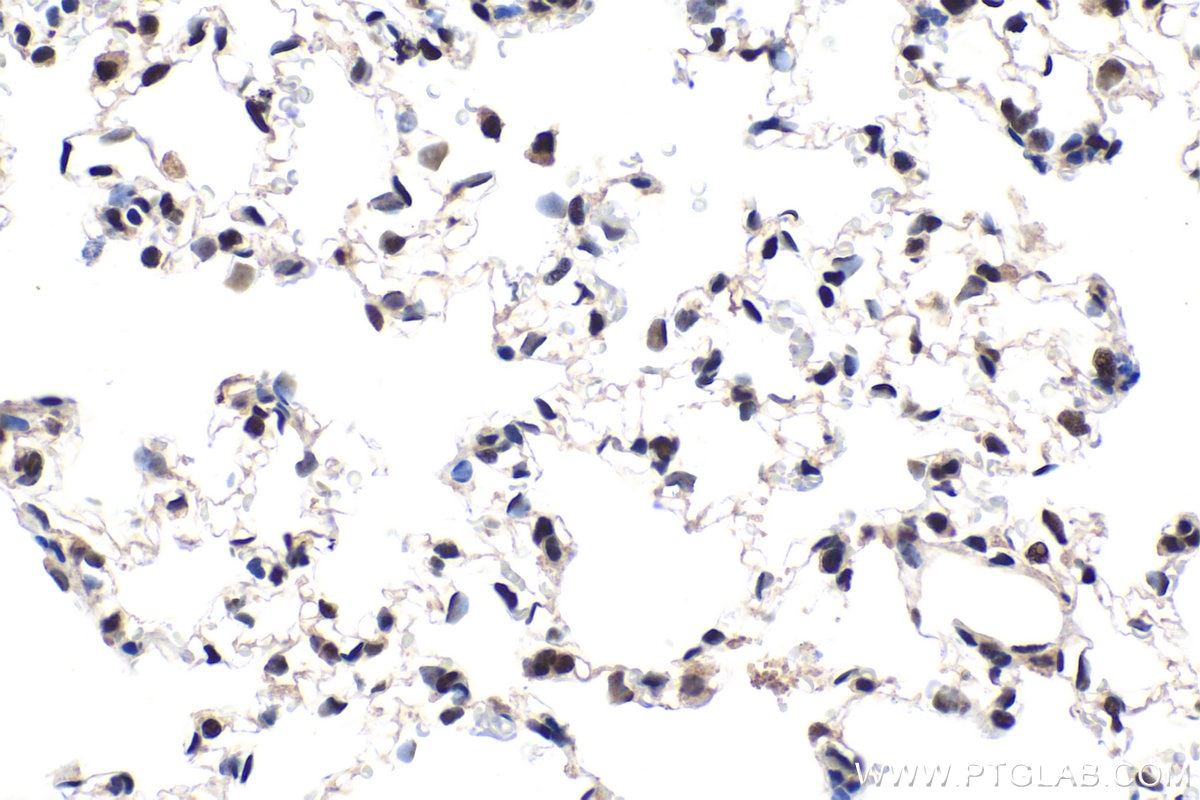 Immunohistochemical analysis of paraffin-embedded rat lung tissue slide using KHC1633 (CTBP2 IHC Kit).