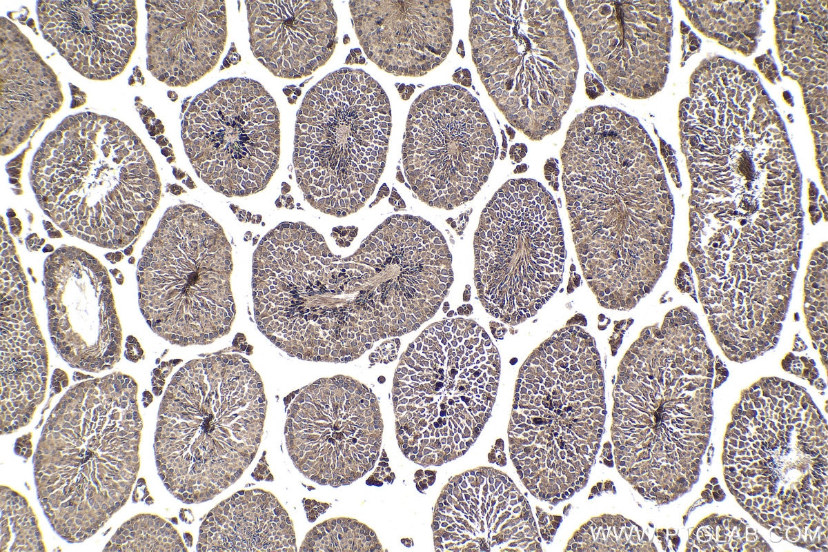 Immunohistochemical analysis of paraffin-embedded mouse testis tissue slide using KHC1841 (CTCFL/BORIS IHC Kit).