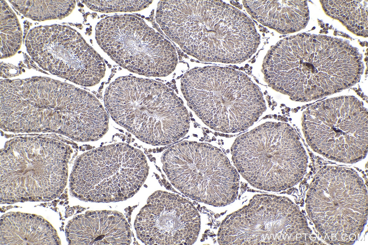 Immunohistochemical analysis of paraffin-embedded rat testis tissue slide using KHC1841 (CTCFL/BORIS IHC Kit).