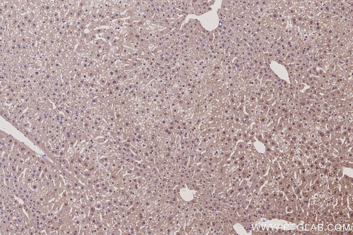 Immunohistochemical analysis of paraffin-embedded mouse liver tissue slide using KHC3100 (CTDSPL2 IHC Kit).