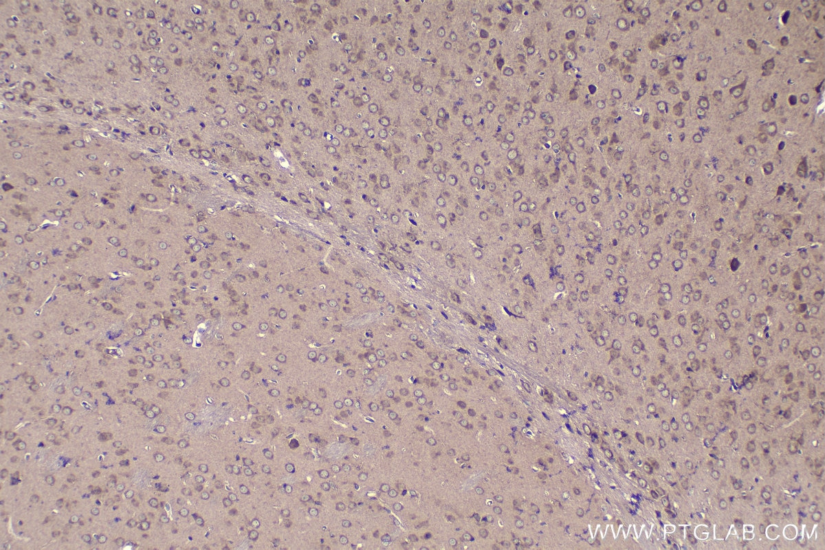 Immunohistochemical analysis of paraffin-embedded mouse brain tissue slide using KHC1108 (CTGF/CCN2 IHC Kit).