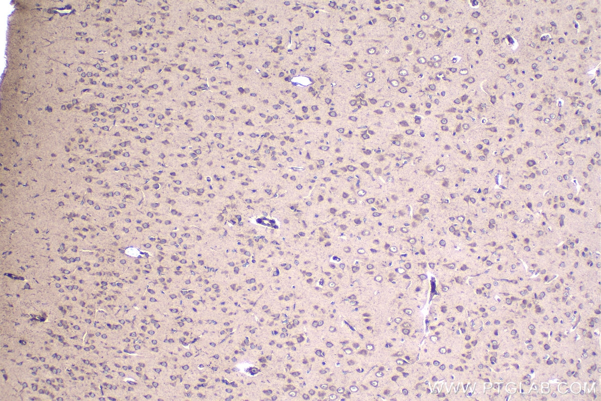 Immunohistochemical analysis of paraffin-embedded rat brain tissue slide using KHC1108 (CTGF/CCN2 IHC Kit).