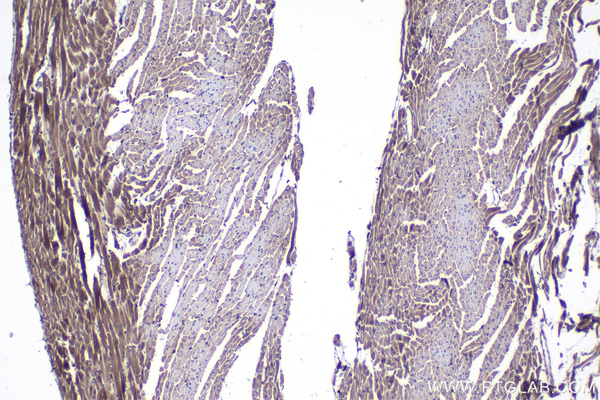 Immunohistochemical analysis of paraffin-embedded mouse heart tissue slide using KHC1108 (CTGF/CCN2 IHC Kit).