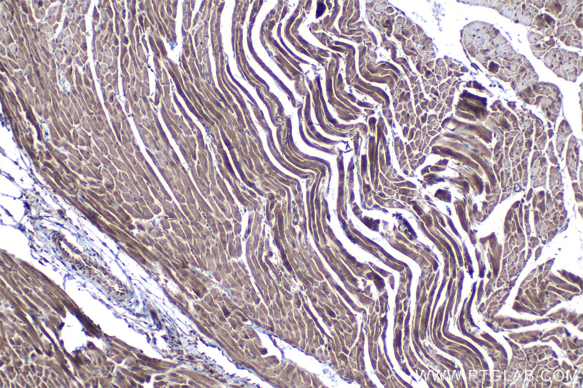 Immunohistochemical analysis of paraffin-embedded rat heart tissue slide using KHC1108 (CTGF/CCN2 IHC Kit).