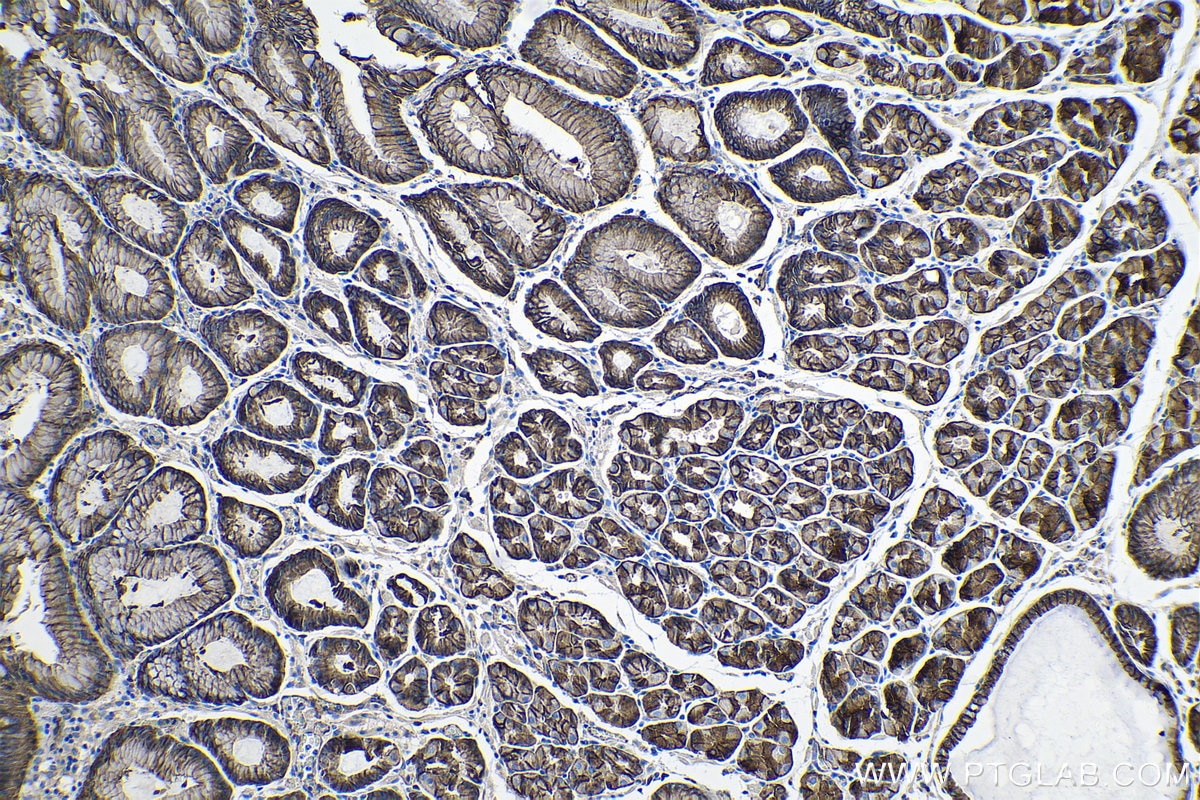 Immunohistochemical analysis of paraffin-embedded human stomach cancer(NAT) tissue slide using KHC0260 (CTNNA1 IHC Kit).