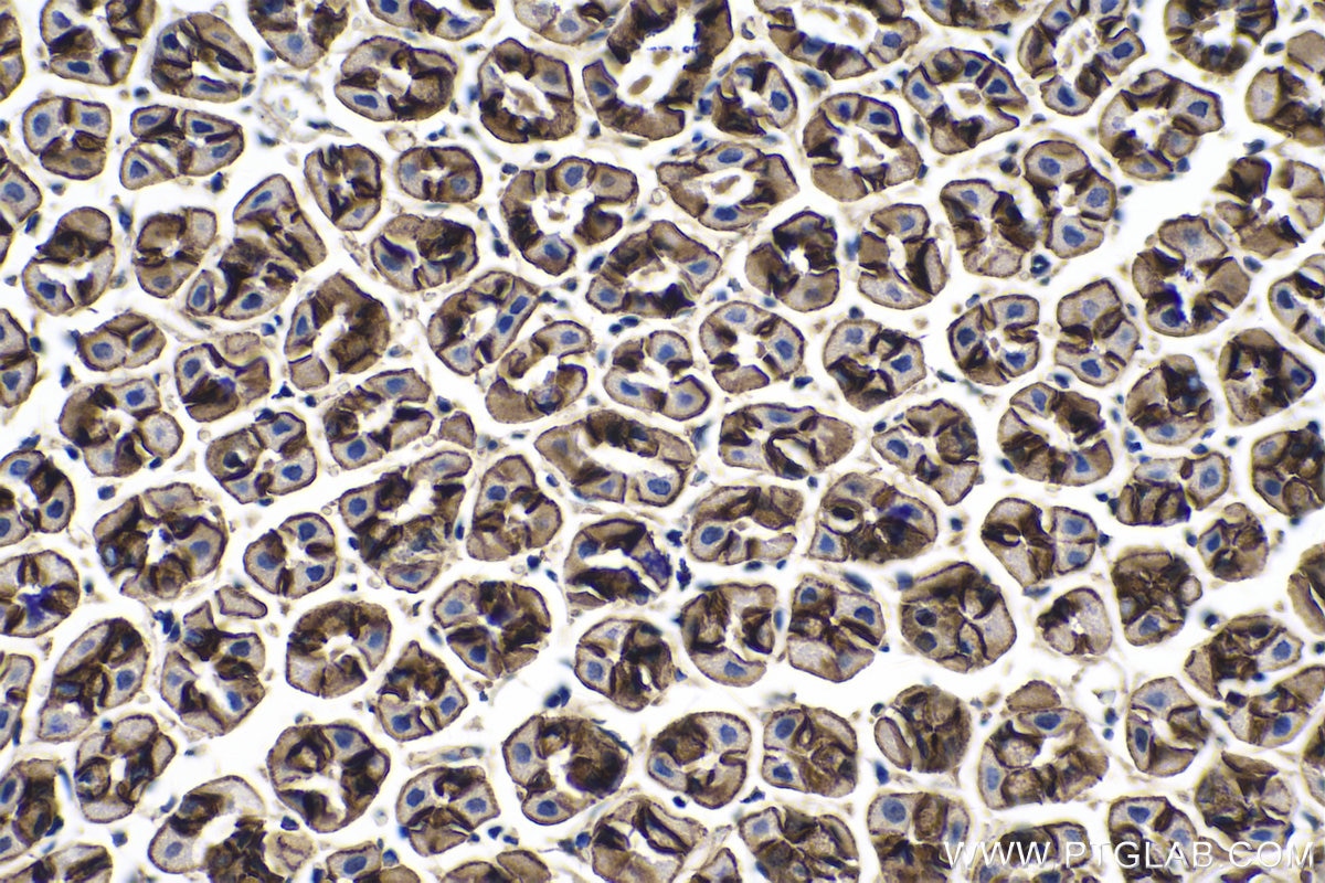 Immunohistochemical analysis of paraffin-embedded mouse stomach tissue slide using KHC0260 (CTNNA1 IHC Kit).