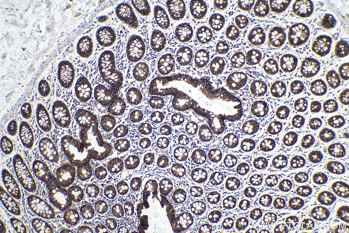 Immunohistochemical analysis of paraffin-embedded human colon tissue slide using KHC0260 (CTNNA1 IHC Kit).