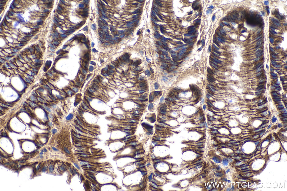 Immunohistochemical analysis of paraffin-embedded mouse colon tissue slide using KHC0260 (CTNNA1 IHC Kit).