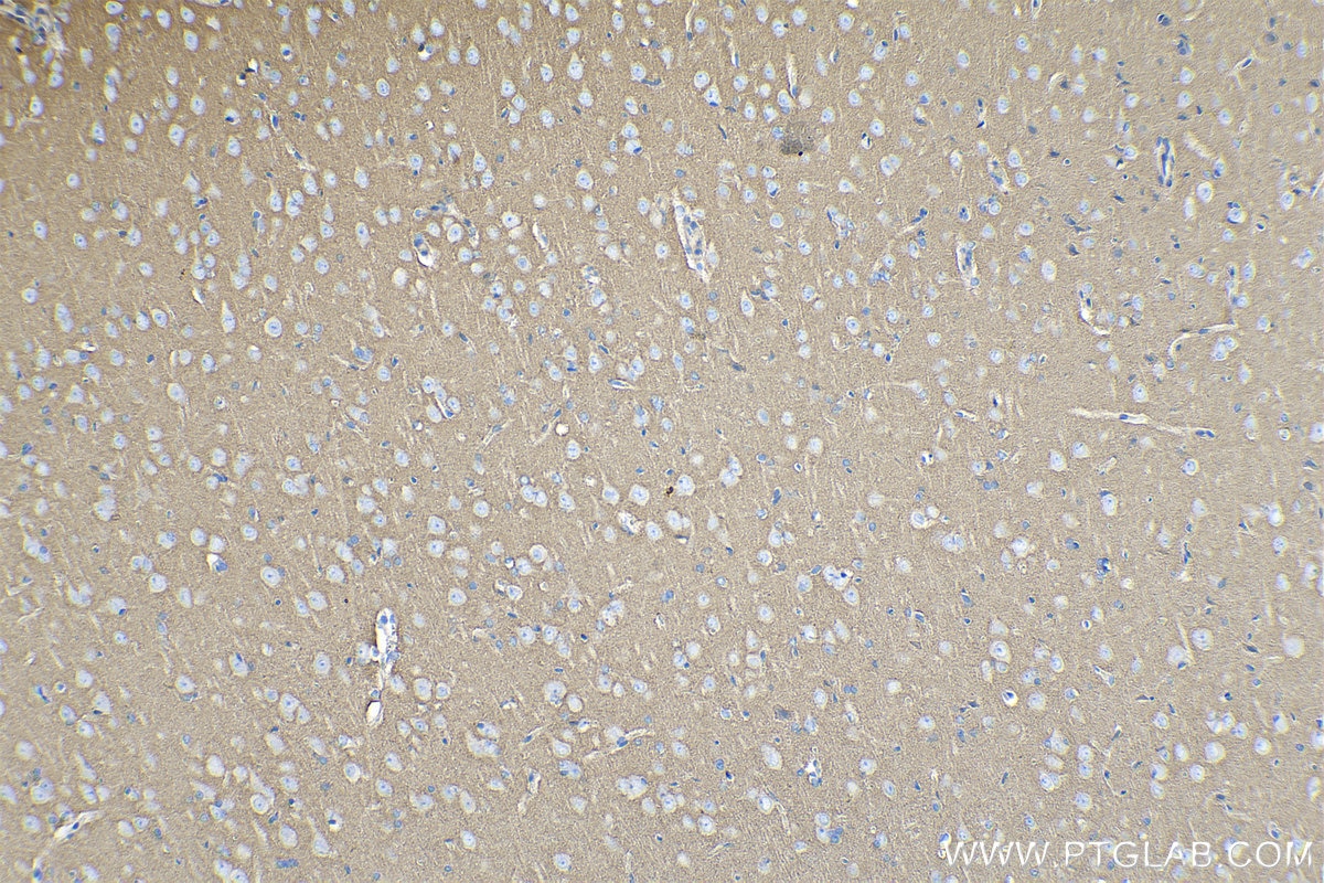 Immunohistochemical analysis of paraffin-embedded rat brain tissue slide using KHC0261 (CTNNA2 IHC Kit).