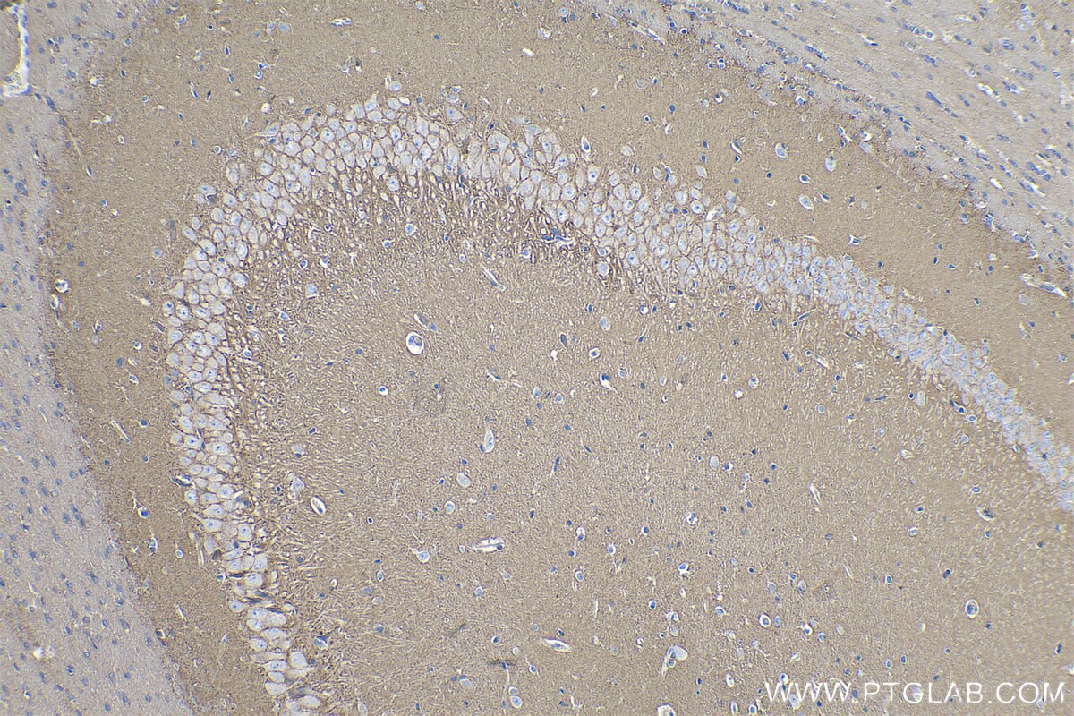 Immunohistochemical analysis of paraffin-embedded rat brain tissue slide using KHC0261 (CTNNA2 IHC Kit).