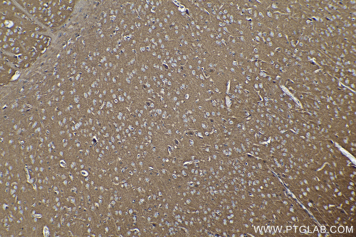 Immunohistochemical analysis of paraffin-embedded mouse brain tissue slide using KHC0261 (CTNNA2 IHC Kit).