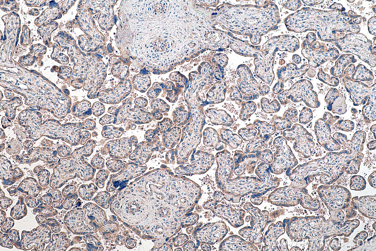 Immunohistochemical analysis of paraffin-embedded human placenta tissue slide using KHC0262 (CTNNA3 IHC Kit).