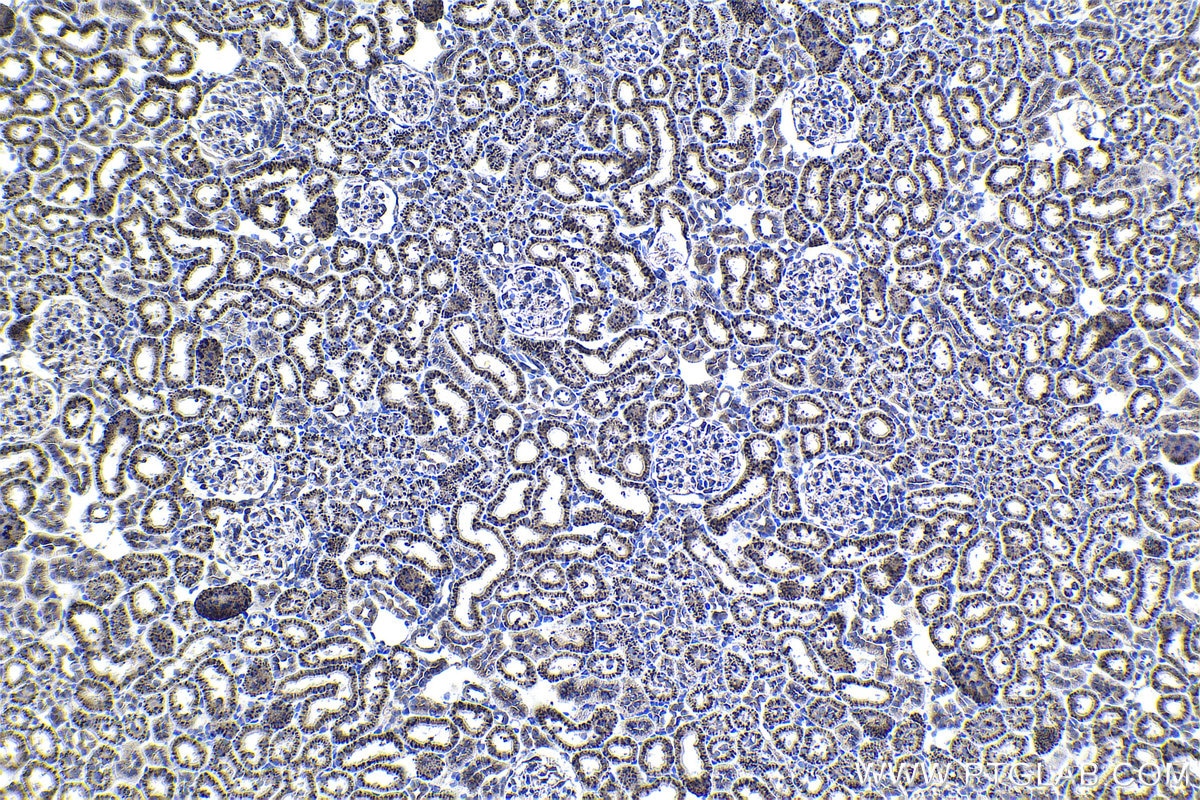 Immunohistochemical analysis of paraffin-embedded rat kidney tissue slide using KHC1125 (CTSA IHC Kit).
