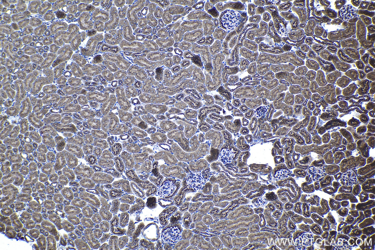 Immunohistochemical analysis of paraffin-embedded mouse kidney tissue slide using KHC1125 (CTSA IHC Kit).