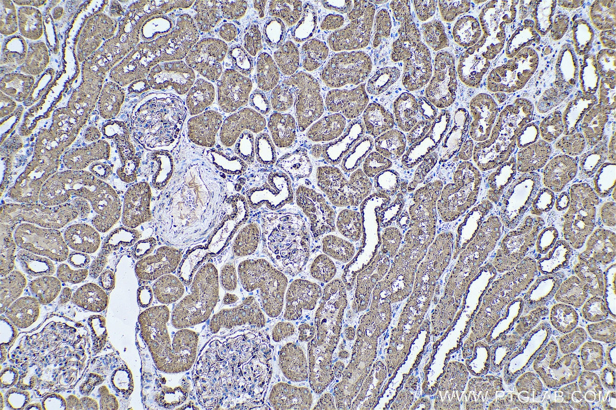 Immunohistochemical analysis of paraffin-embedded human kidney tissue slide using KHC0591 (Cathepsin D IHC Kit).