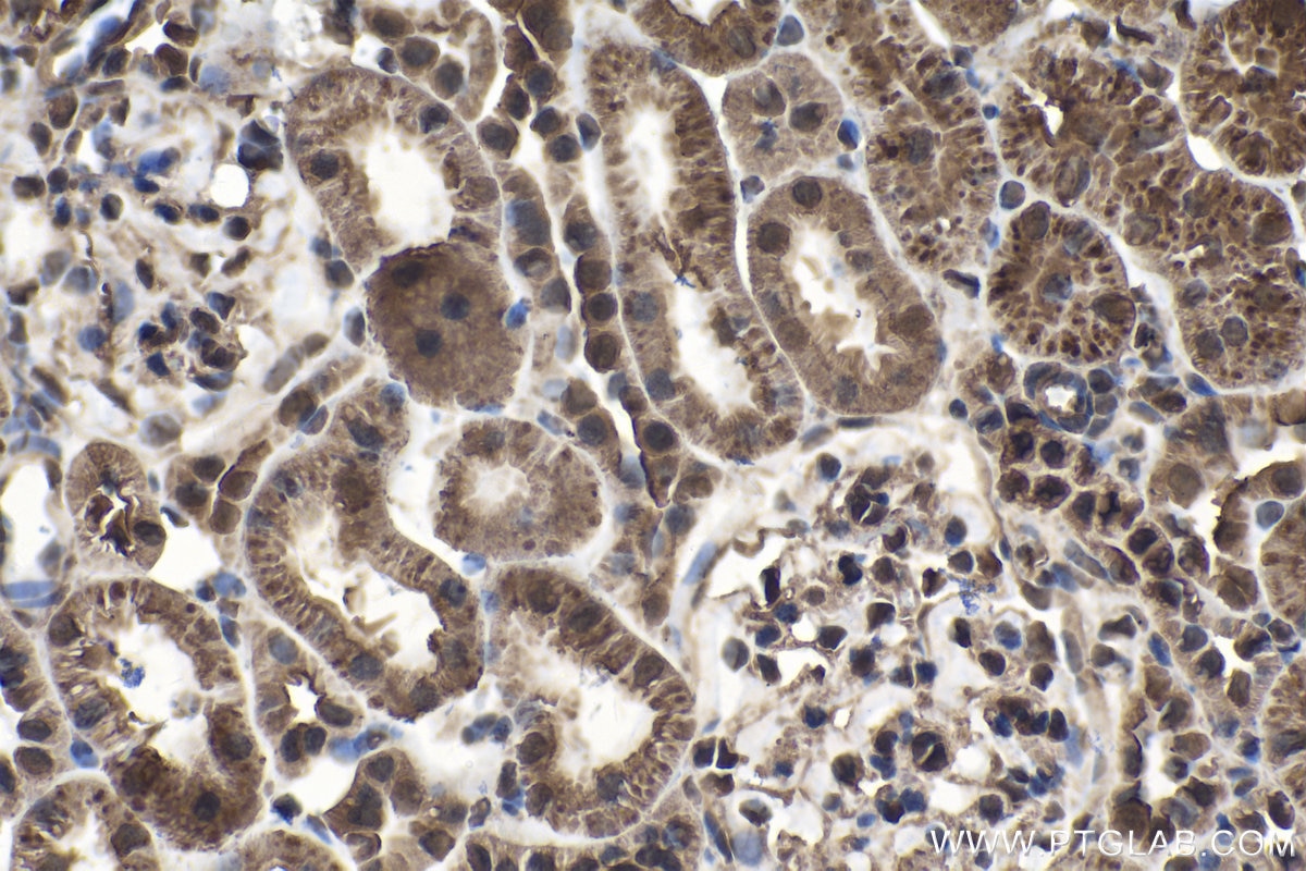 Immunohistochemical analysis of paraffin-embedded rat kidney tissue slide using KHC1512 (CTSL1 IHC Kit).