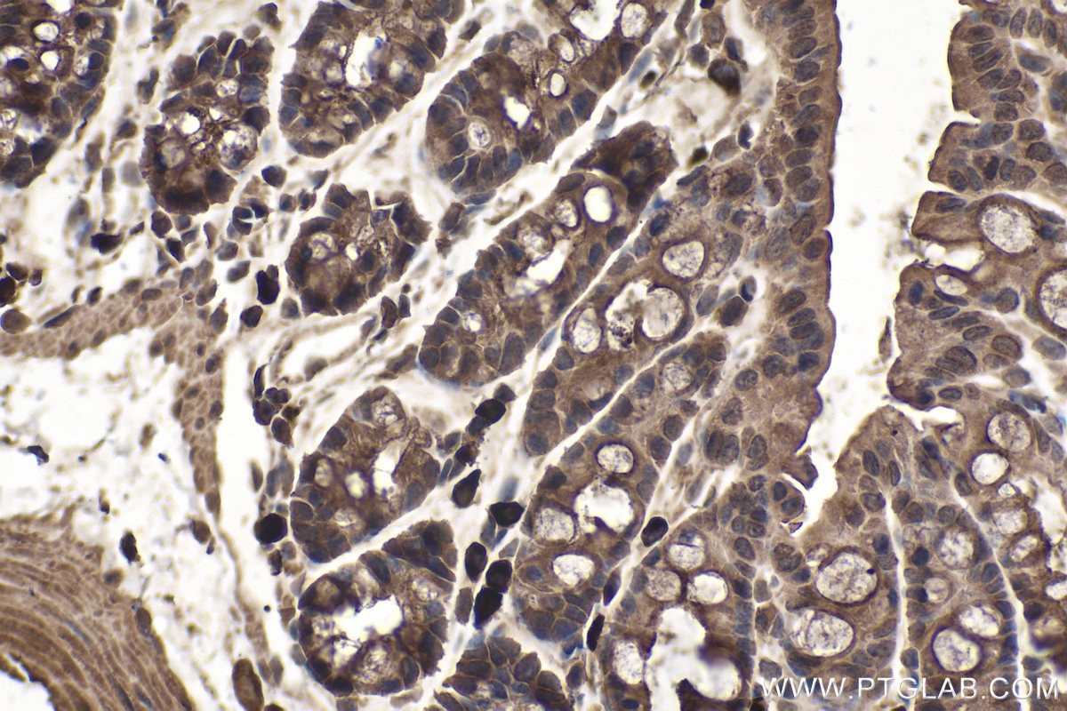 Immunohistochemical analysis of paraffin-embedded mouse colon tissue slide using KHC1512 (CTSL1 IHC Kit).