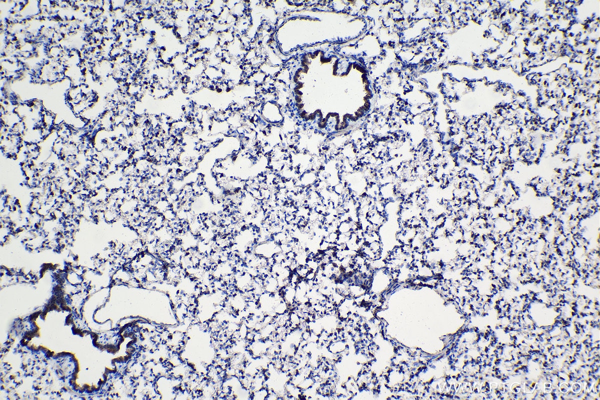 Immunohistochemical analysis of paraffin-embedded rat lung tissue slide using KHC0990 (CTSZ IHC Kit).