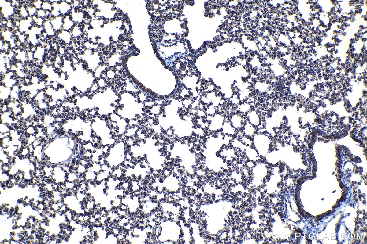 Immunohistochemical analysis of paraffin-embedded mouse lung tissue slide using KHC1121 (CUGBP2 IHC Kit).