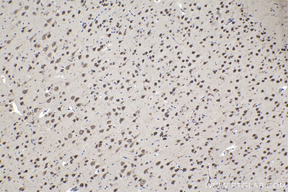 Immunohistochemical analysis of paraffin-embedded rat brain tissue slide using KHC1121 (CUGBP2 IHC Kit).