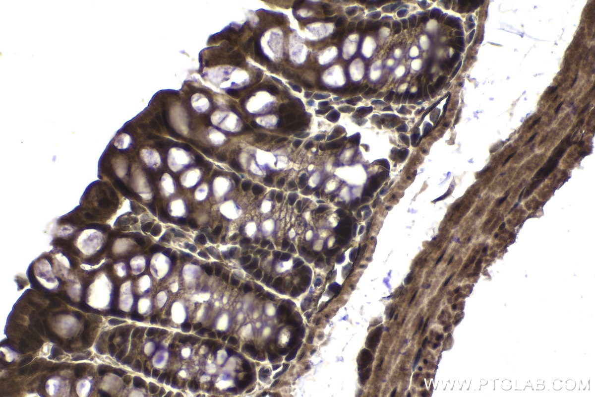 Immunohistochemical analysis of paraffin-embedded mouse colon tissue slide using KHC1035 (CUL1 IHC Kit).