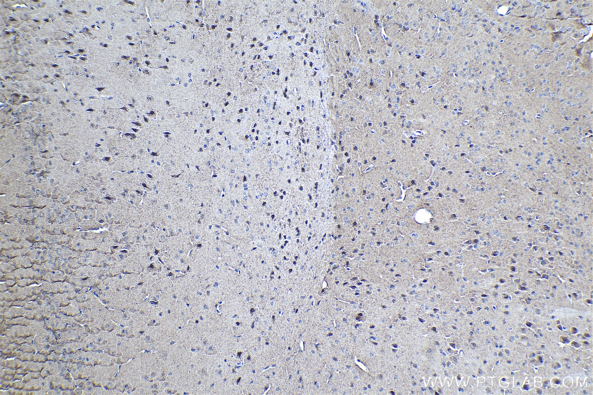 Immunohistochemical analysis of paraffin-embedded mouse brain tissue slide using KHC1066 (CUL3 IHC Kit).