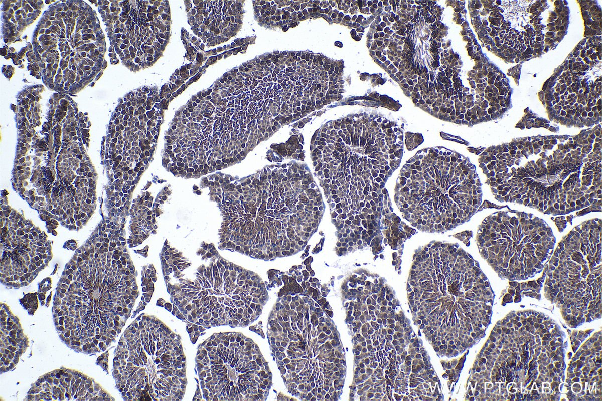 Immunohistochemical analysis of paraffin-embedded mouse testis tissue slide using KHC1066 (CUL3 IHC Kit).