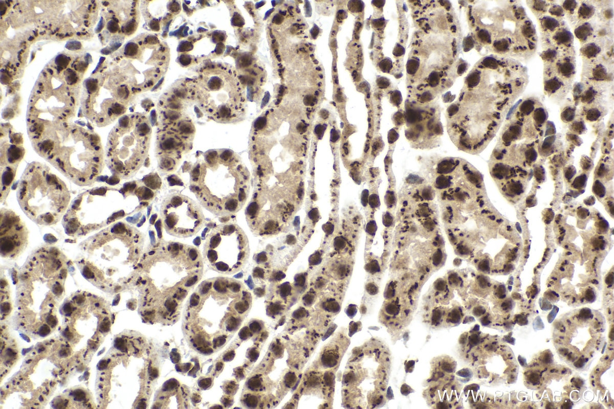 Immunohistochemical analysis of paraffin-embedded mouse kidney tissue slide using KHC1590 (CUX1 IHC Kit).