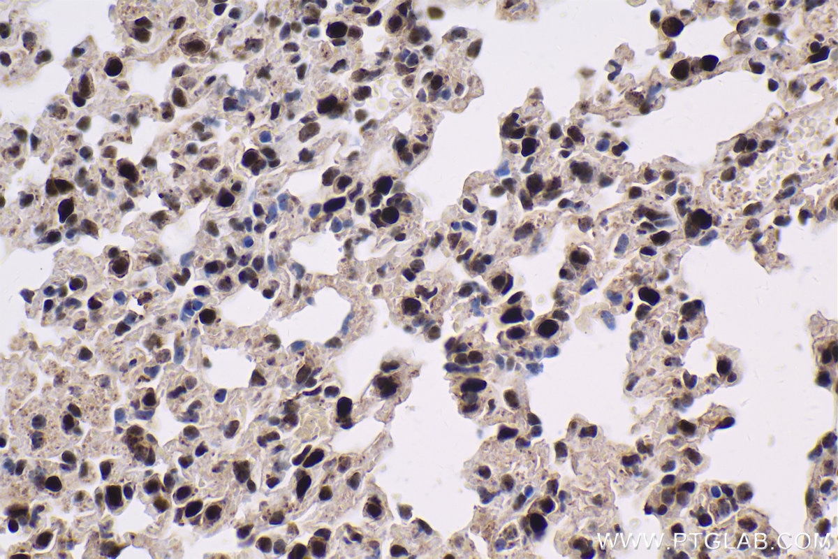 Immunohistochemical analysis of paraffin-embedded mouse lung tissue slide using KHC1590 (CUX1 IHC Kit).