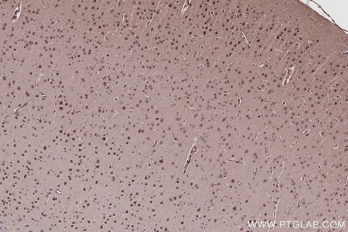 Immunohistochemical analysis of paraffin-embedded rat brain tissue slide using KHC3103 (CWF19L1 IHC Kit).