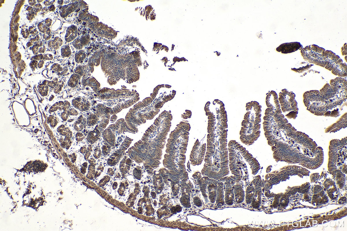 Immunohistochemical analysis of paraffin-embedded mouse small intestine tissue slide using KHC1070 (CX3CL1 IHC Kit).